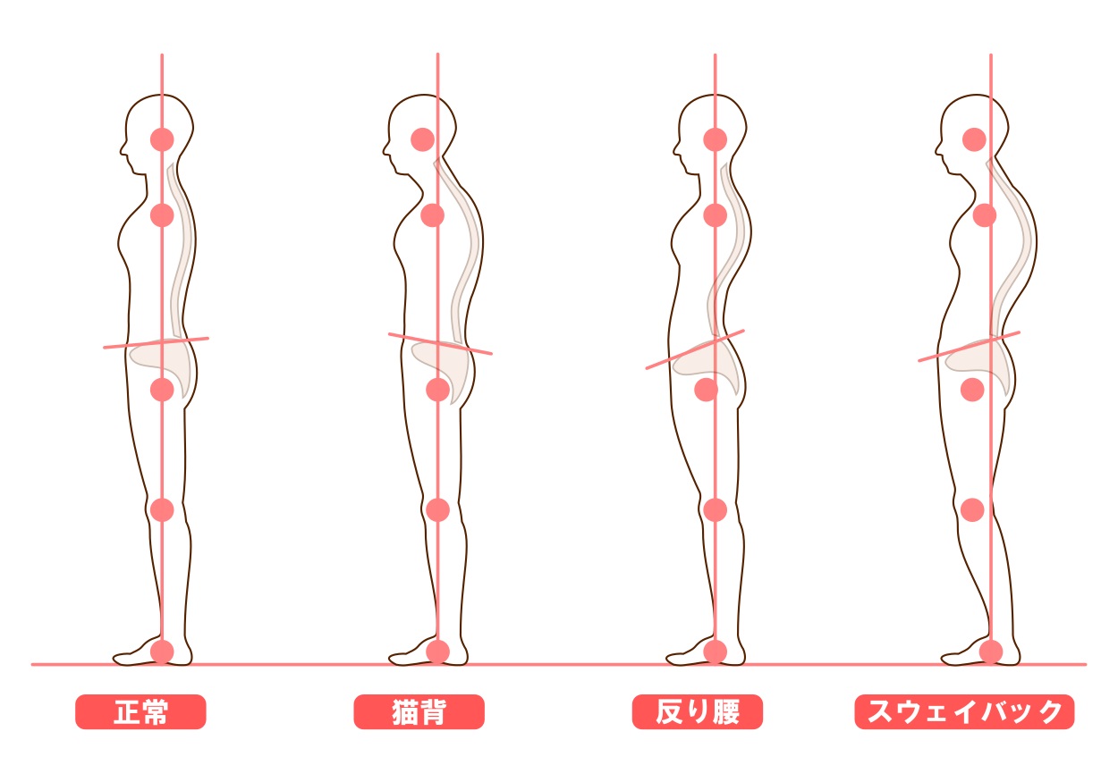 気になる姿勢改善は骨盤矯正が得意な整骨院で！上尾で始める本格ケア 画像