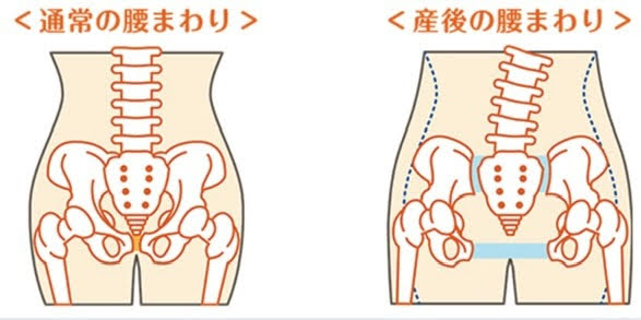 上尾で産後の骨盤矯正なら整骨院へ！専門施術で根本改善を目指す 画像