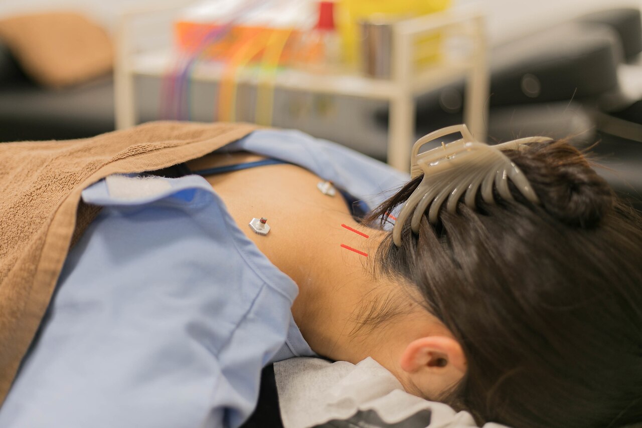 自律神経が不安定な方へ｜上尾の整骨院が鍼灸施術で体質改善をサポート 画像